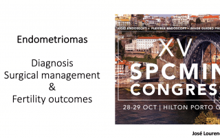 Endometriomas (quistos ovários) - José Reis